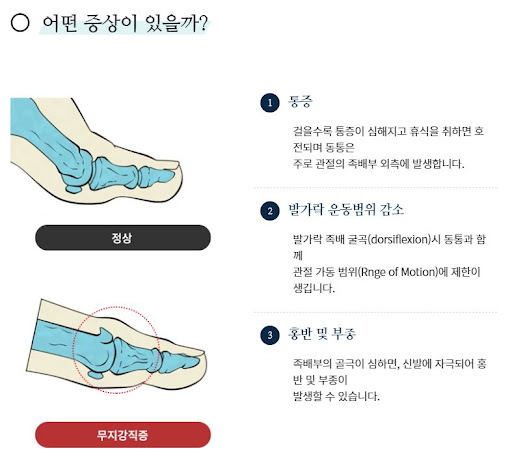 신림정형외과 - 바른사랑병원